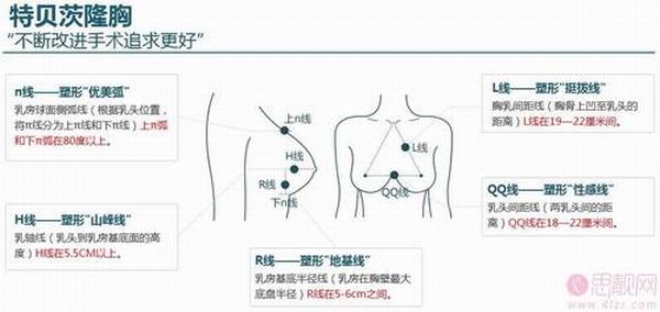 上海华美谢卫国隆胸特贝茨隆胸好不好