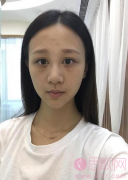 上海全面部填充秒变小仙女