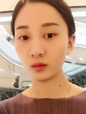 乐山经纬医美美容门诊部价格表，附激光祛斑真人案例