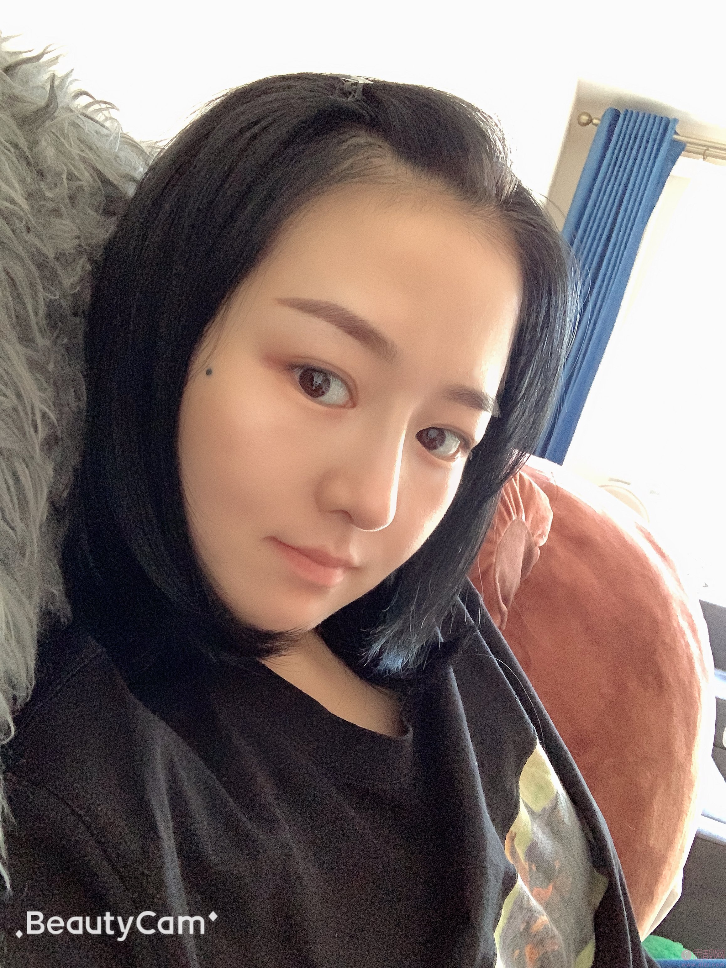 大连瑞和医疗美容杨柠泽隆鼻好不好？附隆鼻前后对比及2020最新价格表一览