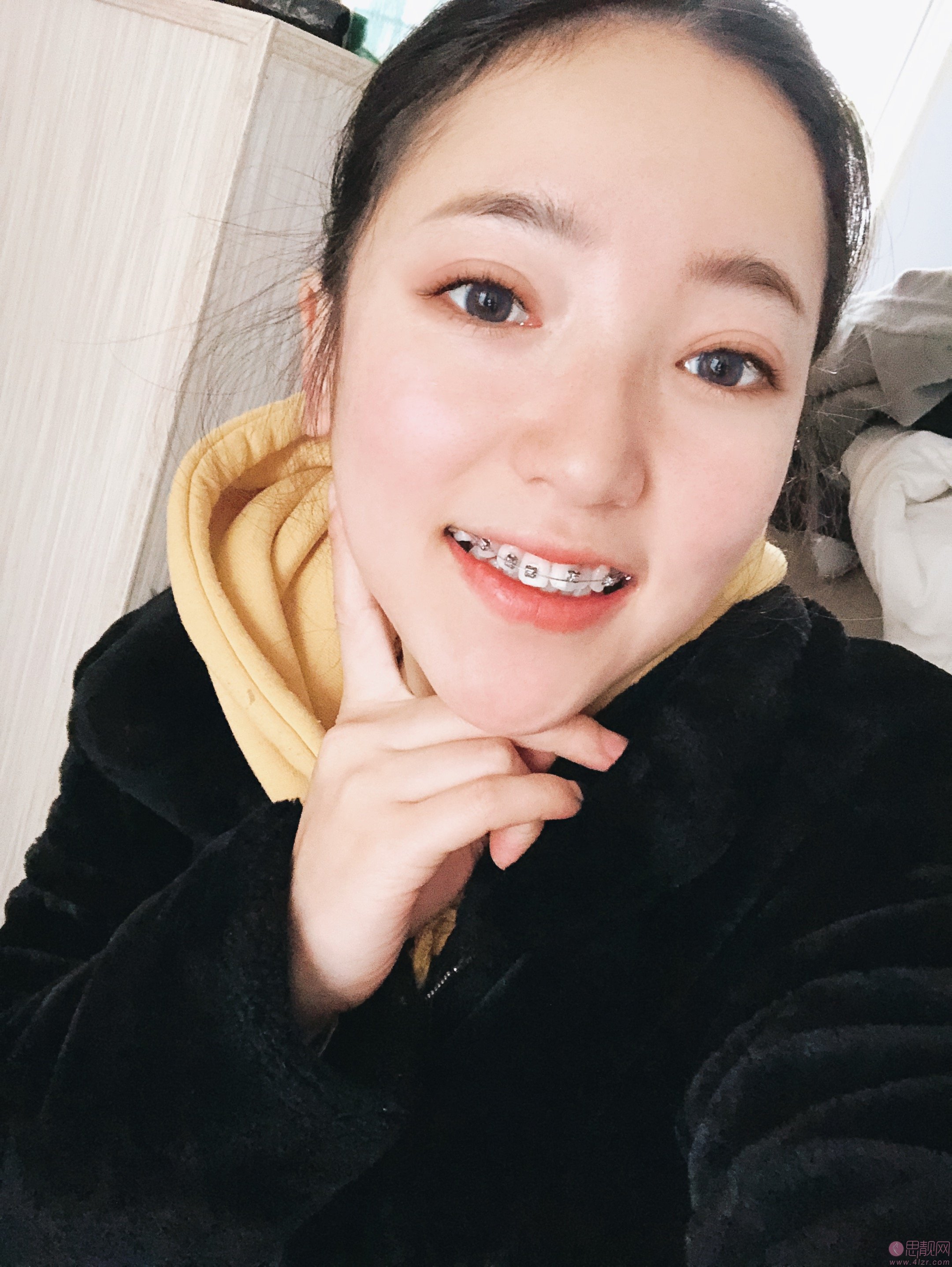 长沙美莱医疗美容口腔科肖归林隐形矫正怎么样？附矫正案例对比及2020价格表曝光