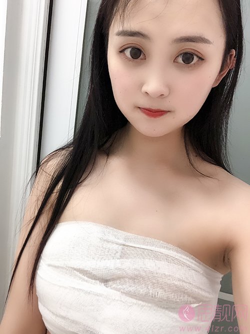 成都恒博天姿医疗美容李烈隆胸怎么样？附隆胸案例对比及2020最新价格表出炉