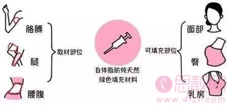 面部填充术后可以洗脸化妆吗？