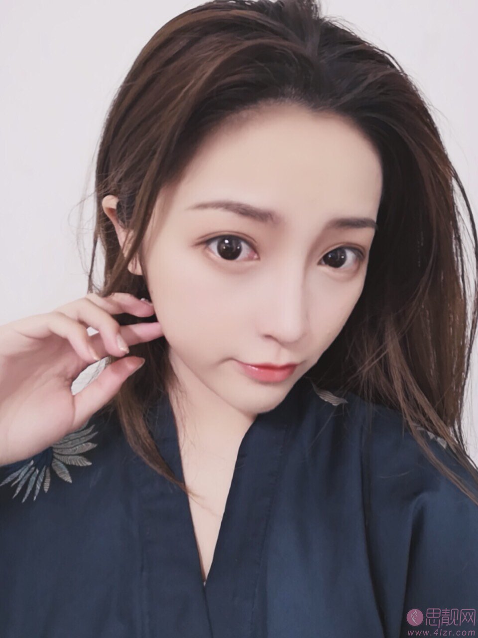 厦门思明欧菲美容医院隆鼻好不好，附隆鼻案例对比及2020价格表曝光