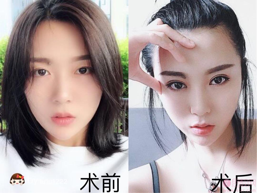 厦门欣医美整形外科门诊部怎么样？附医院简介及2020价格表一览