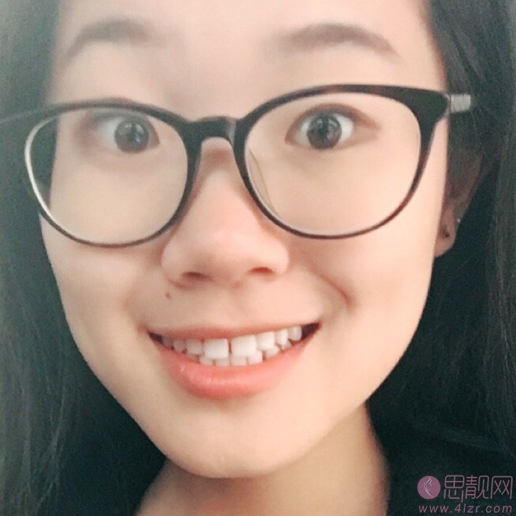 上海圣贝口腔门诊部李多娇美白牙齿怎么样？2020价格表出炉