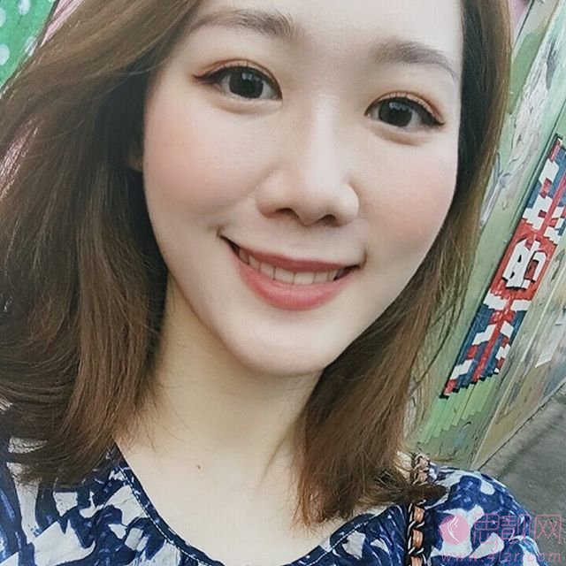 深圳微尔口腔牙齿美白怎么样？附美白拳皇对比效果及2020价格表一览