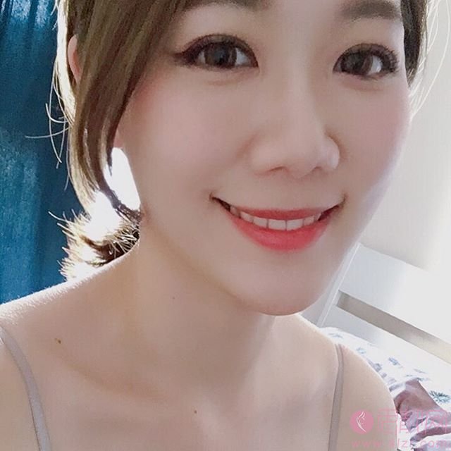 深圳微尔口腔牙齿美白怎么样？附美白拳皇对比效果及2020价格表一览