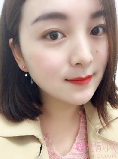 郑州缔莱美医疗美容医院杨胜发面部吸脂怎么样？附2020价格表一览