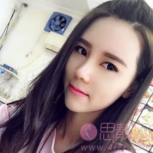 大连明医汇整形李耀宇隆鼻好不好？附隆鼻案例前后对比效果及2020价格表全新上线