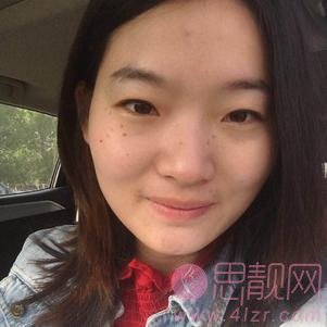 北京佳妍医疗美容诊所祛斑怎么样？2020价格表曝光+祛斑前后对比案例