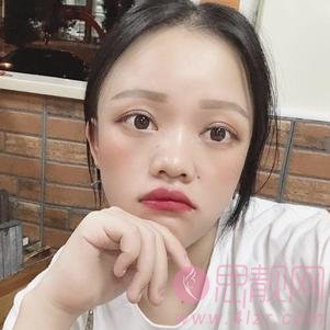 长沙素妍医疗美容李源海肋软骨隆鼻怎么样？附隆鼻案例前后对比及2020价格表全新上线