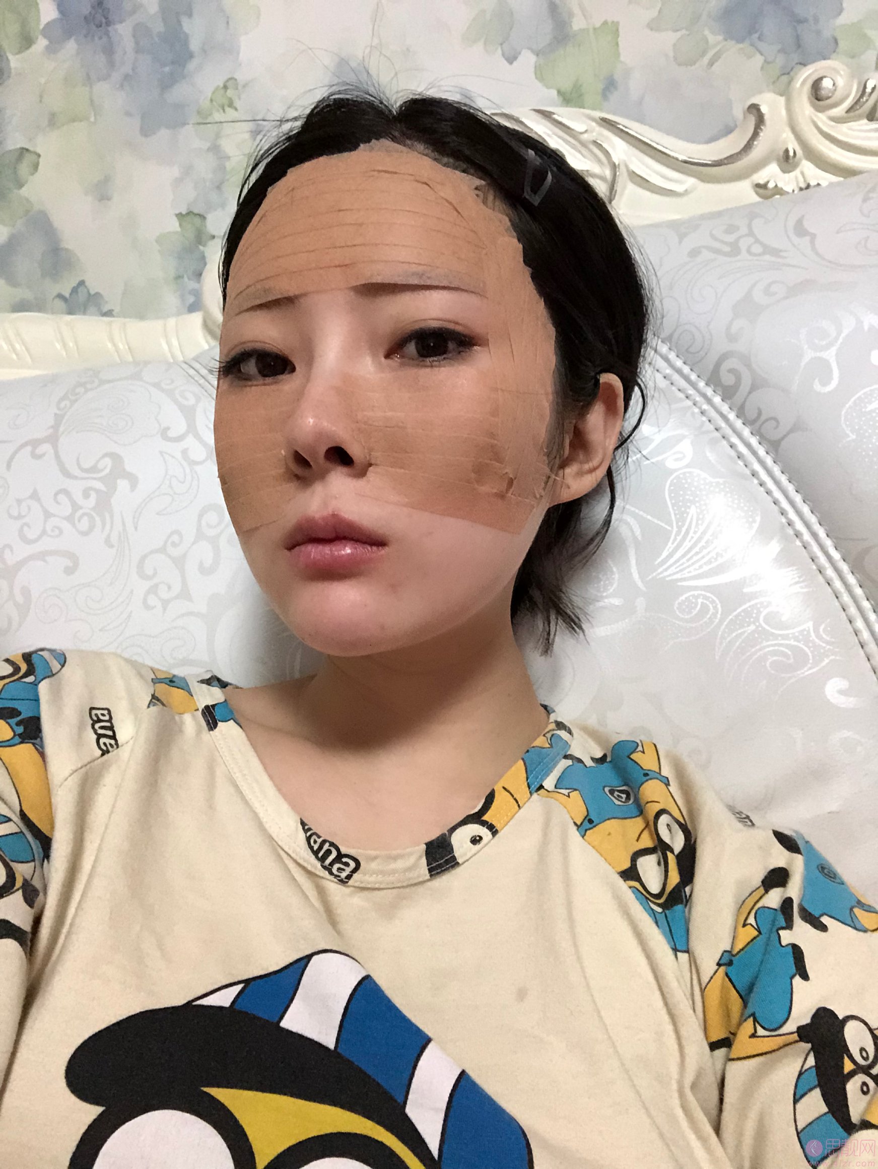 济南美辰医疗美容医院怎么样？2020价格表全新上线+自体脂肪填充全脸前后对比案例