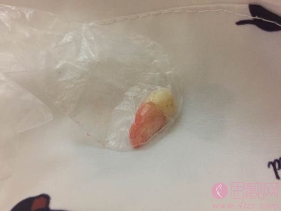 泰康拜博口腔（长春红旗店）牙齿矫正如何。附矫正案例及2020价格表出炉