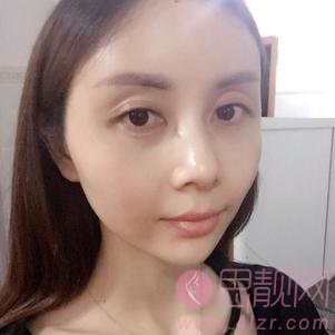 成都百龄驻颜医学美容自体脂肪全脸填充怎么样？2020价格表上线