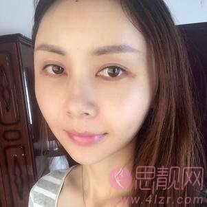 成都百龄驻颜医学美容自体脂肪全脸填充怎么样？2020价格表上线