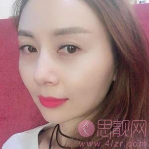 成都百龄驻颜医学美容自体脂肪全脸填充怎么样？2020价格表上线