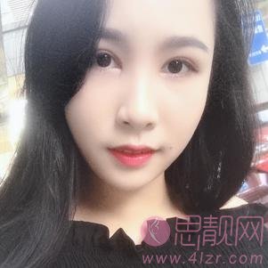 上海华美医疗美容医院杨亚益做双眼皮好不好？附双眼皮真人分享及2020价格表上线