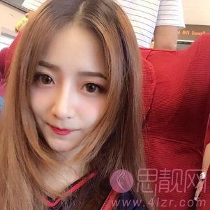 上海美莱医疗美容卢建隆鼻怎么样？附隆鼻真人案例前后对比及2020价格表一览