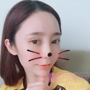 成都美容整形医院王立鹏做双眼皮怎么样？2020价格表曝光+双眼皮真人案例分享