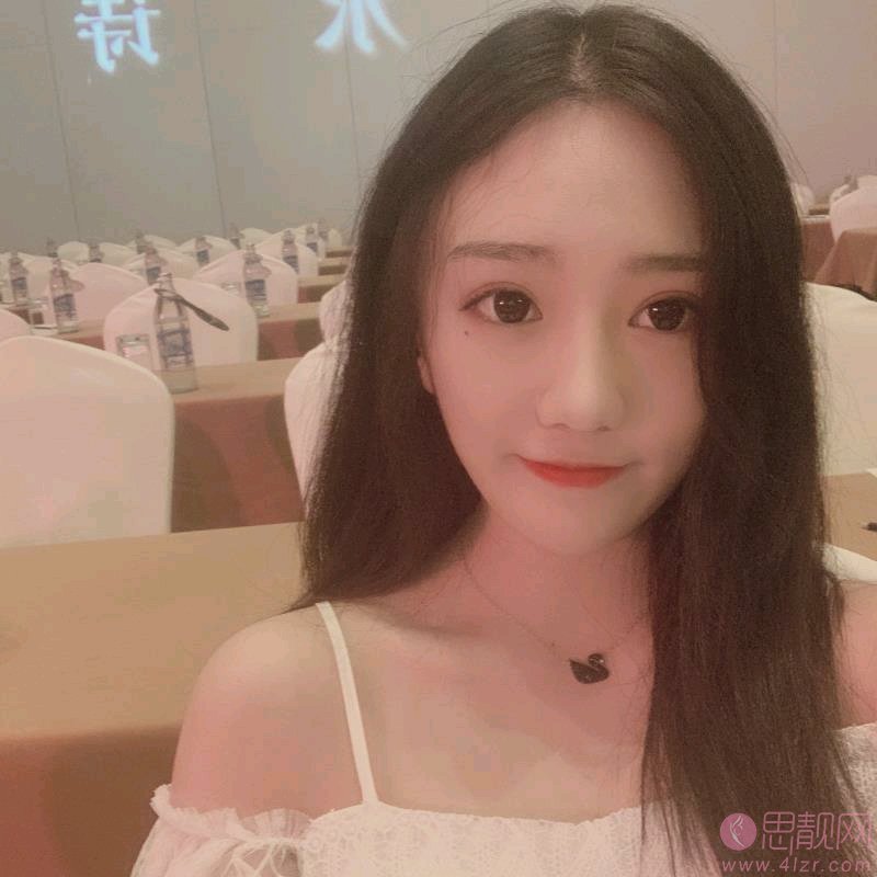 上海鹏爱医疗美容门诊部李涛玻尿酸隆鼻如何？2020价格表一览