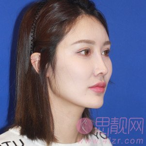 上海喜美医疗美容门诊部王会勇鼻修复怎么样？附鼻修复案例真人分享及2020价格表曝光