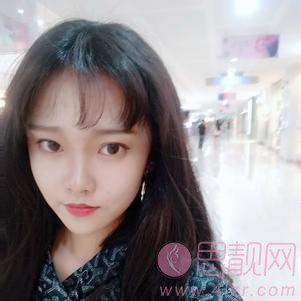 脸博士整形美容做埋线提升怎么样？2020价格表曝光+埋线提升真人分享案例