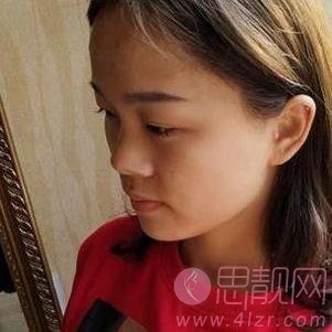 福州海西迪娅医疗美容整形医院做隆鼻手术如何？2020价格表一览