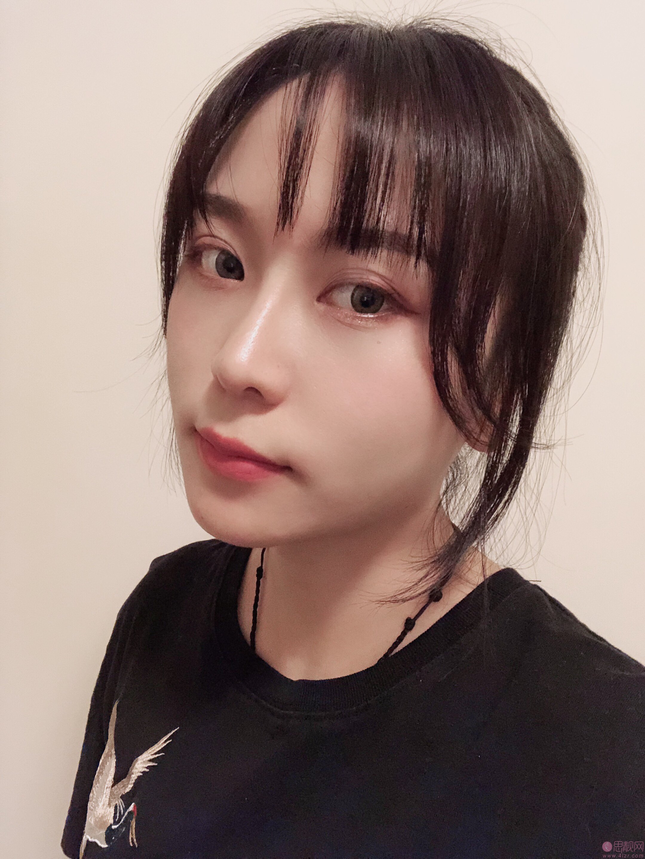 成都格莱丽整形美容肖凌隆鼻怎么样.2020价格表一览+术后恢复案例展现