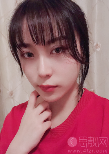 成都格莱丽整形美容肖凌隆鼻怎么样.2020价格表一览+术后恢复案例展现