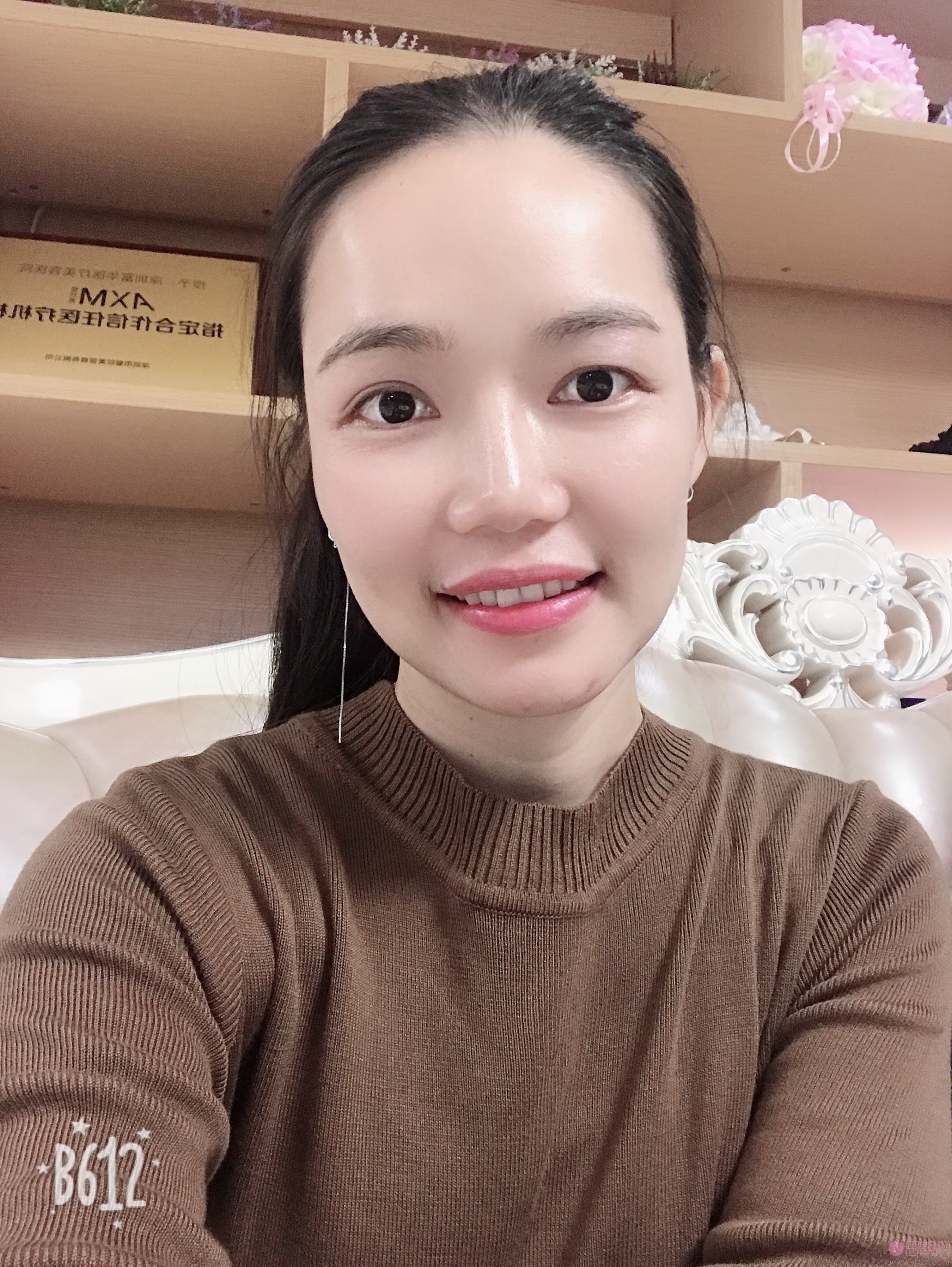 上海美莱医疗美容口腔科美白牙齿怎么样？2020价格表上线+牙齿美白真人案例