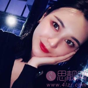 成都美未央医疗美容隆鼻怎么样？2020价格表曝光+隆鼻真人案例分享