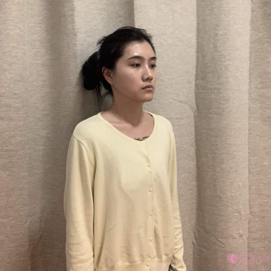 成都美绽美整形美容医院杨平做假体隆胸好不好？2020价格表全新上线+隆胸真人案例分享