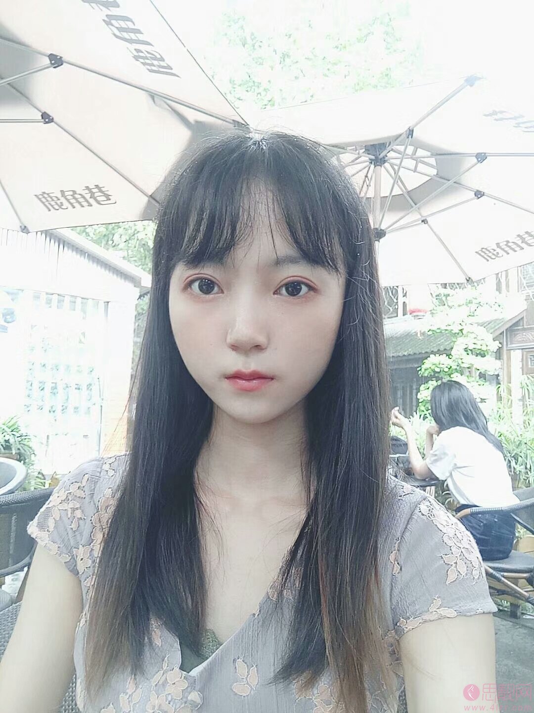 成都仪美美仁医疗美容做双眼皮怎么样？2020价格表上线+双眼皮真人案例分享