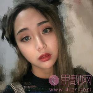 悦丽美科（私密医美中心）激光祛斑怎么样？2020价格表一览+激光祛斑真人案例分享