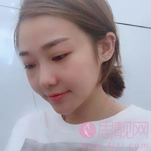 北京斯嘉丽医疗美容宋磊医生做自体脂肪填充全脸怎么样？2020价格表曝光