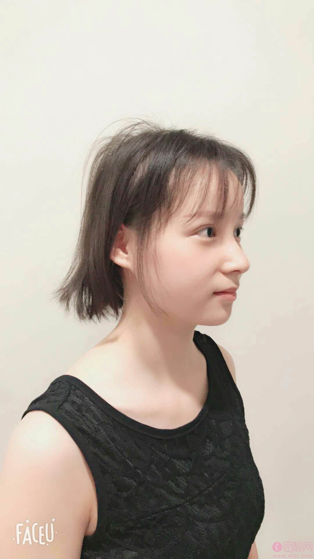 苏州美莱美容医院张亮医生隆鼻好不好？2020价格表曝光+隆鼻真人案例一览