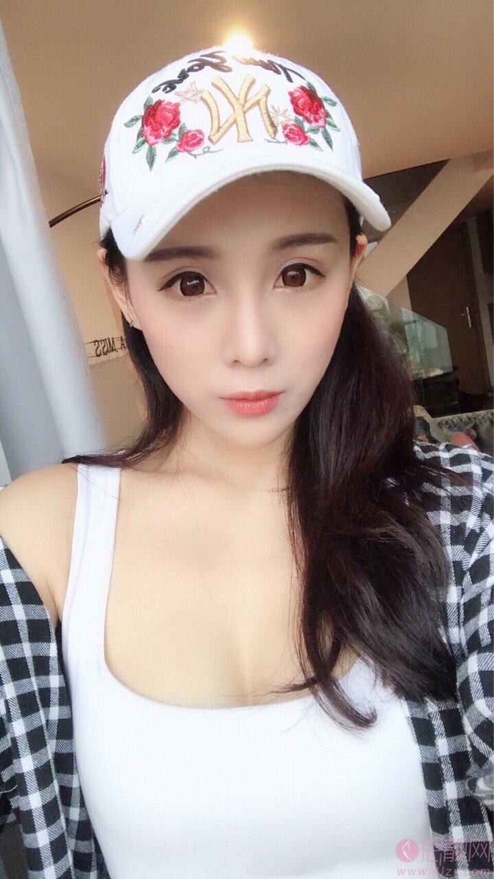 昆明美伊莱医疗美容门诊部周诚隆鼻好不好？2020价格表一览+隆鼻真人案例术后反馈