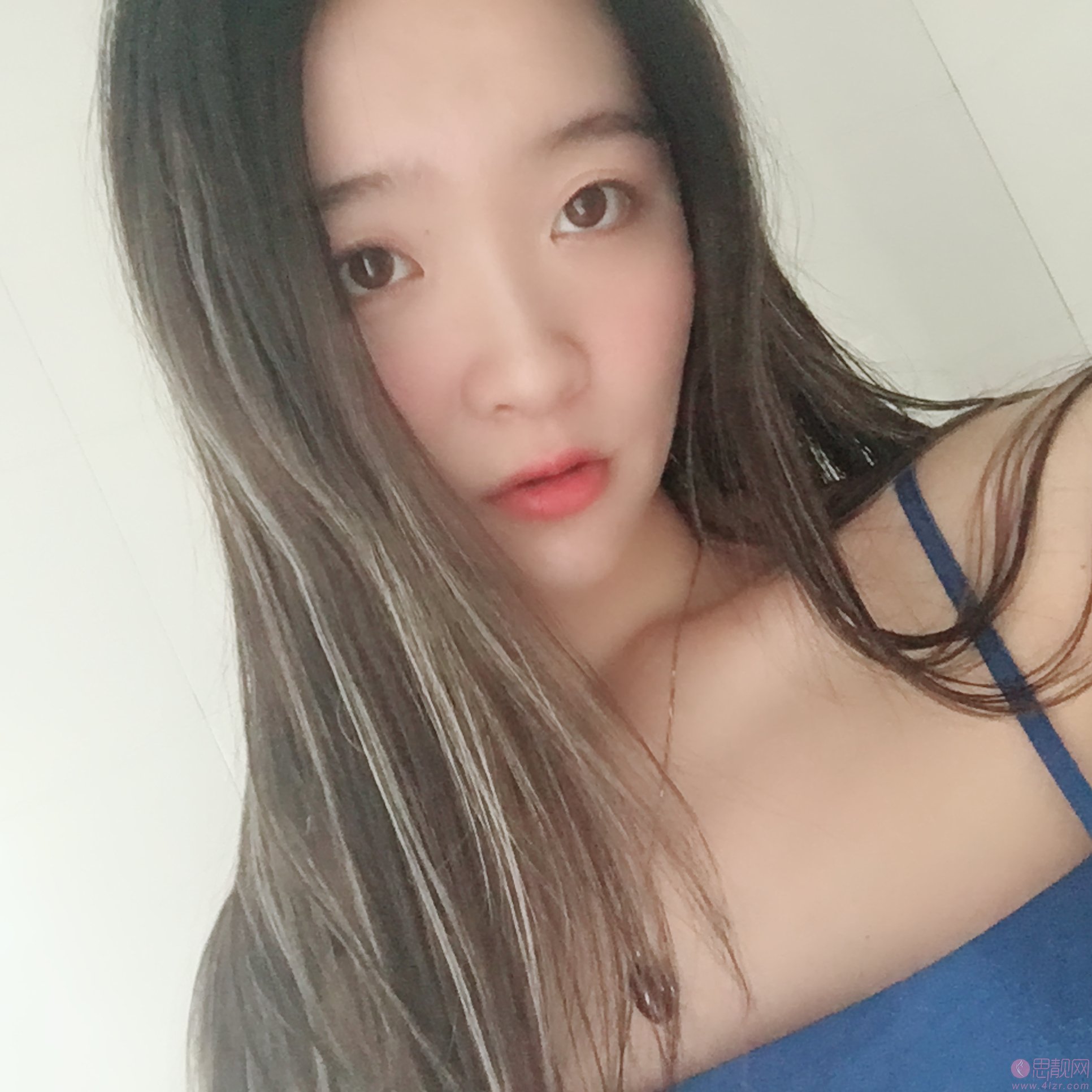 昆明吴氏嘉美美容医院庄蔚强隆鼻好不好？2020价格表上线