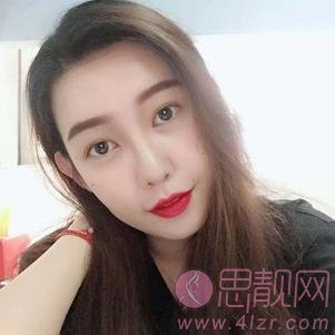 广州可玫尔艺美医疗美容李闯隆鼻怎么样？附隆鼻术后真人案例一览及2020价格表曝光