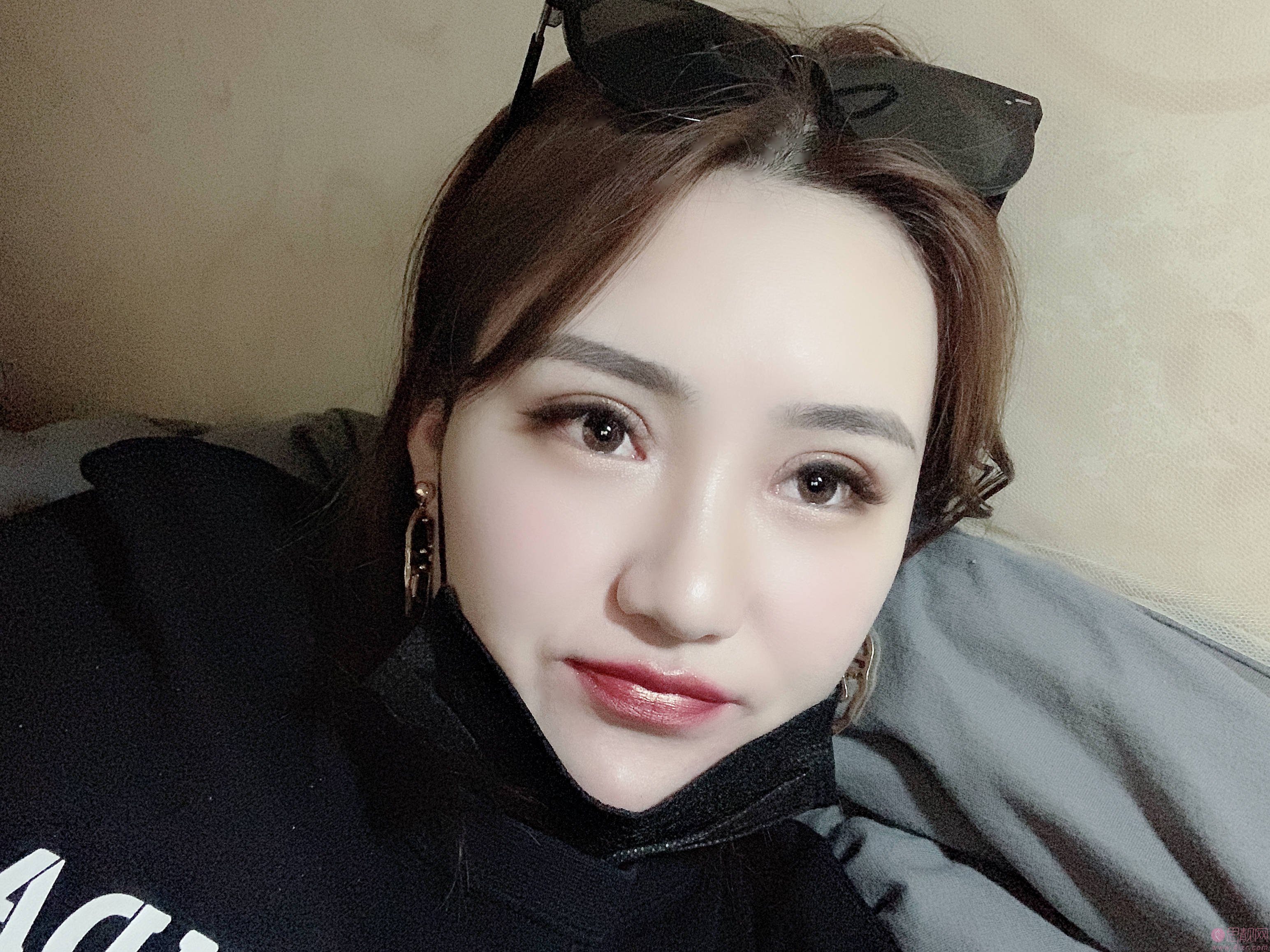 北京彤美医美美容门诊部刘风卓做双眼皮好不好？2020价格表上线+双眼皮真人案例分享