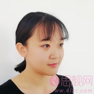 珠海爱思特美容专科医院隆鼻好不好？2020价格表出炉+隆鼻真人案例一览