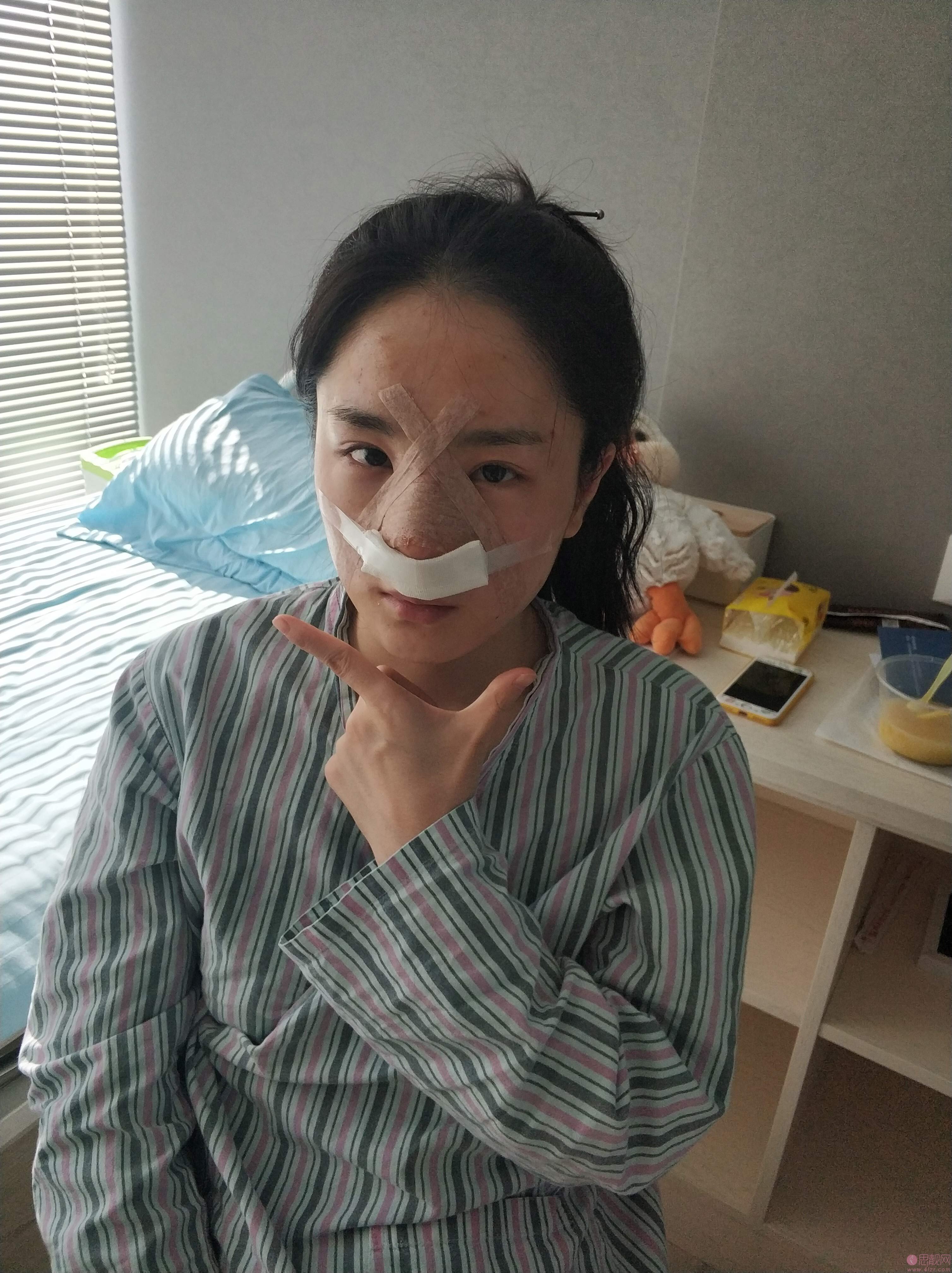 北京正美医疗美容诊所郑永生做歪鼻矫正怎么样？2020价格表一览+矫正术后案例一览