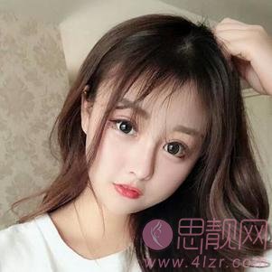 长沙美德思医疗美容隆鼻好不好？2020价格表发布+真人案例分享