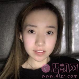 南宁贺尔美医疗美容贺永奎隆鼻好不好？附隆鼻真人案例一览及2020价格表发布