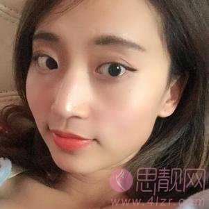 武汉乐美医疗美容汪文娟做埋线提升好不好？2020价格表公布