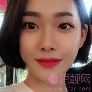 常熟瑞丽美贝尔整形美容医院注射瘦脸好不好？2020价格表曝光+注射瘦脸案例一览