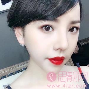 贵阳美莱医疗美容医院隆鼻怎么样？附隆鼻案例及2020价格表一览