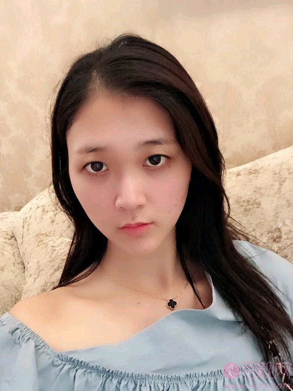 西安美莱医院曾熬医生隆鼻好不好?附隆鼻真人案例及2020价格表隆重上线