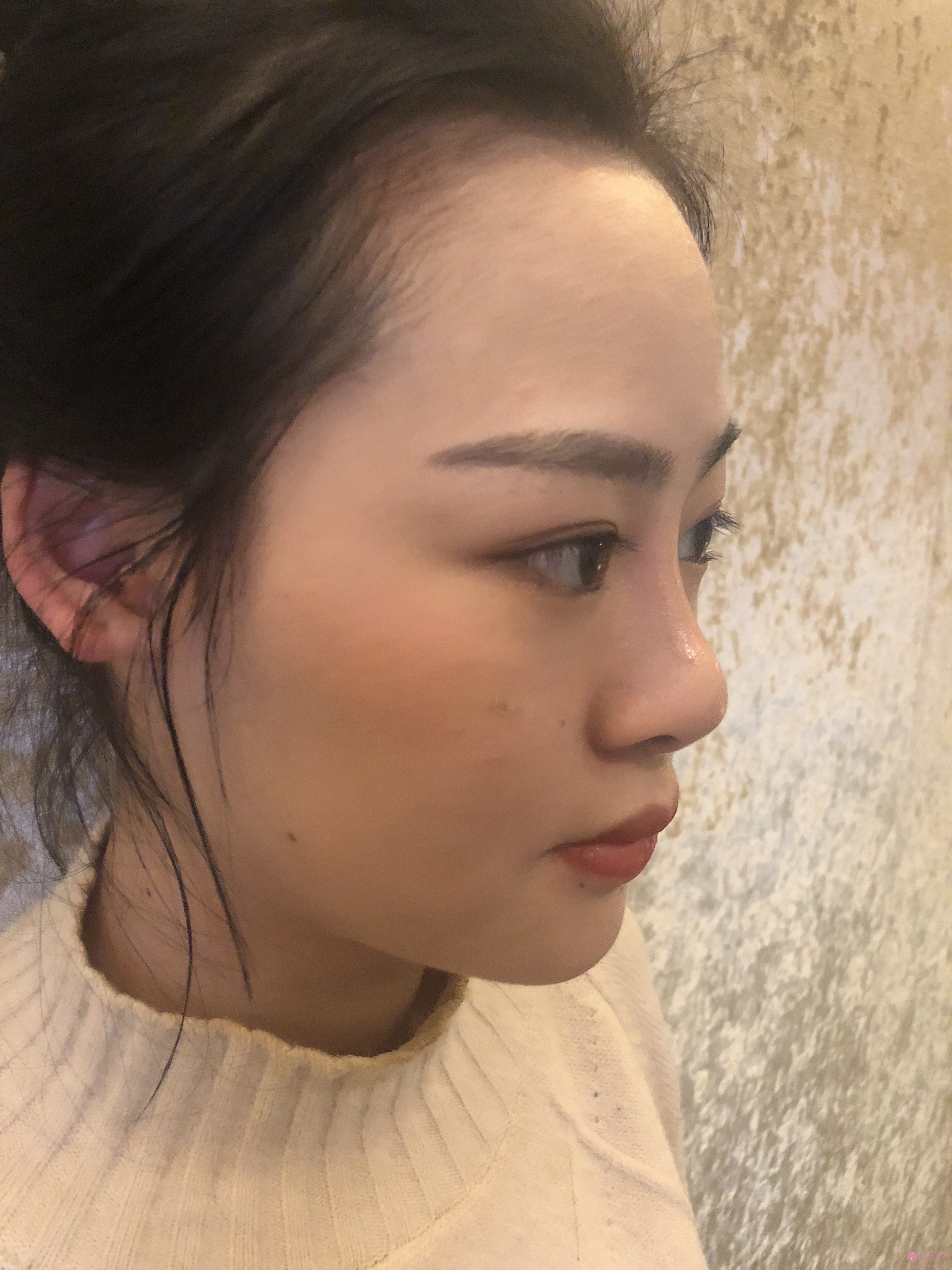 成都润美玉之光整形黄开亮隆鼻如何？附隆鼻案例及2020价格表一览